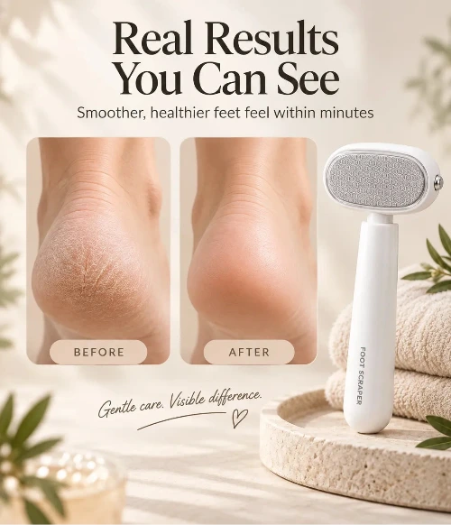 The Heel Eraser - Guarded Callus Peeler At Home